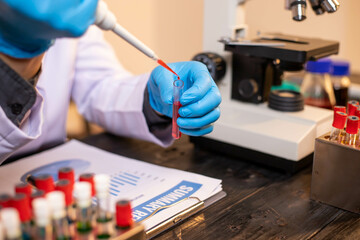 Human hand in glove holding glass jar in modern laboratory. Close-up and long exposure photography.