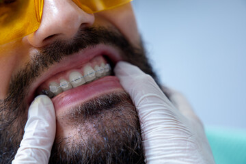 Naklejka premium Man in protective glasses in dentist chair having teeth care procedures