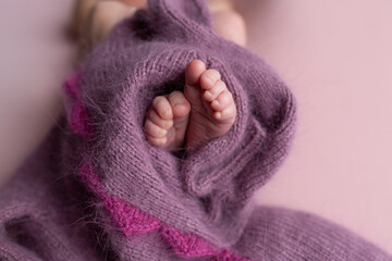 the legs of the newborn baby. the legs of the newborn flaky skin. peel off the skin. peeling skin newborn. newborn child. feet