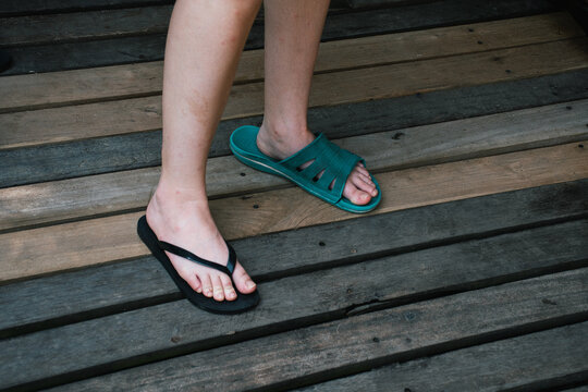 Woman's mismatched sandals 