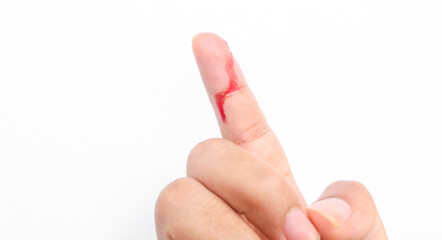 Wound on finger with blood from knife cut. Close up of human finger injured and bleeding with...