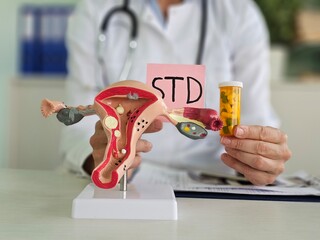 Model of the uterus and birth control pills std. Drug treatment of the cervix concept