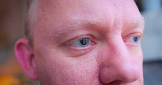Close-up of a man dilated pupils, detailed view of human eyes. after ophthalmologist performed a pupil dilation to examine the retina