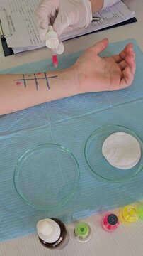 Skin allergy testing process in a dermatology clinic with description of allergens