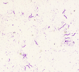 Crimson red spirochetes is a spiral shaped bacterium that is Gram negative and generally undergoes...