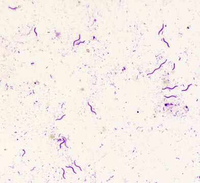 Crimson red spirochetes is a spiral shaped bacterium that is Gram negative and generally undergoes anaerobic phototrophic living.Magnify 400x