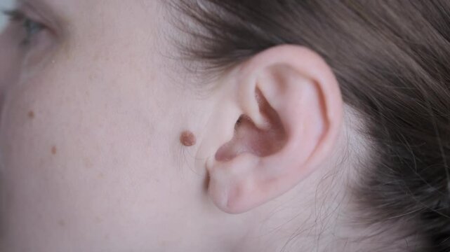 Woman slowly moving her ear, revealing a birthmark located behind her ear, showcasing natural skin features