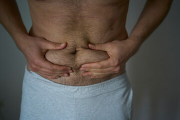 A 30-year-old man of medium build rubs the folds of skin and fat with his hands