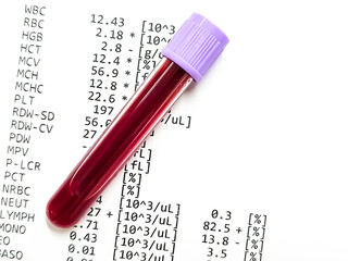 Closeup of blood sample isolated with abnormal CBC report. Anemia, Hemolytic anemia. Low RBC (Hb).
