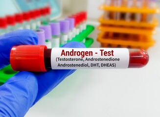 Blood sample for Androgen test, a group of hormone test including testosterone,...