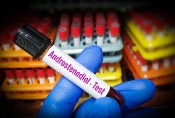 Androstenediol Hormone blood test, Male hormone