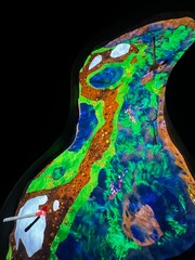 Abstract Map
