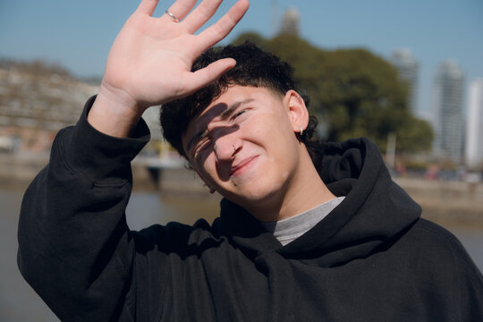 Young man with vitiligo is uncomfortable with the midday sun