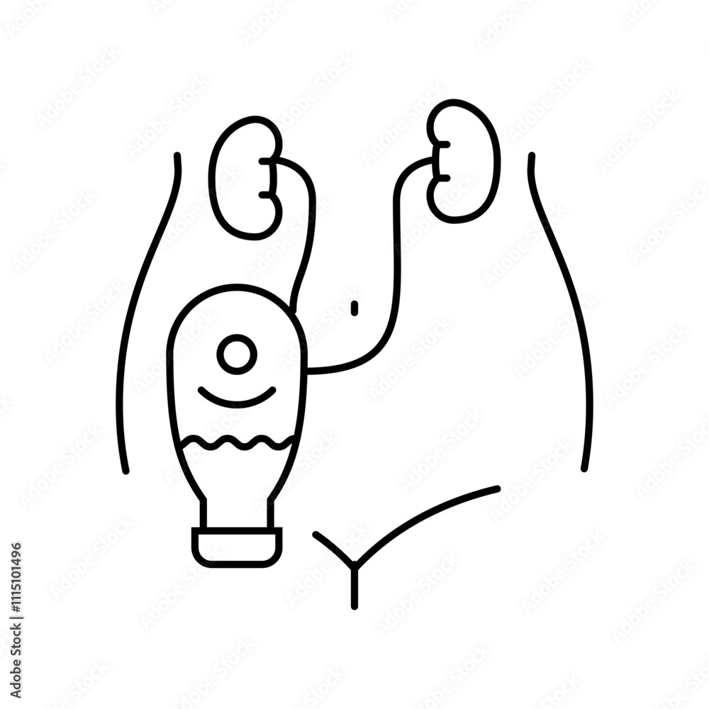 Poster hydronephrosis urology line icon vector. hydronephrosis urology sign. isolated contour symbol black 