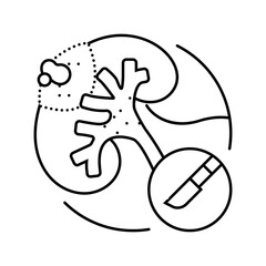 urostomy urology line icon vector. urostomy urology sign. isolated contour symbol black illustration