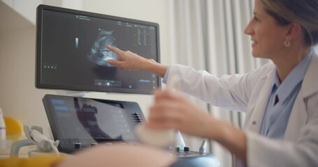 Close Up on Doctor's Hand Using Advanced Ultrasound Equipment to Examine a Pregnant Woman, Explaining Details About the Fetus. Excited Female Patient Smiling as She Sees the Baby’s Image on Display