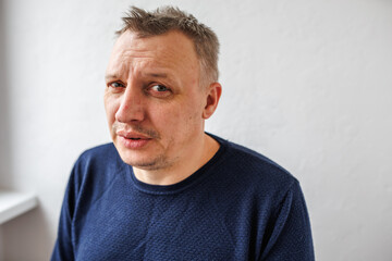 Fototapeta premium distorted face of a sad and sorrowful very upset man