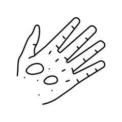 epidermolysis bullosa disease line icon vector. epidermolysis bullosa disease sign. isolated contour symbol black illustration