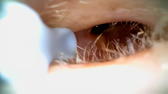 Medical otoscope is providing a close up view of an ear canal with earwax and fine hairs, highlighting potential ear health issues