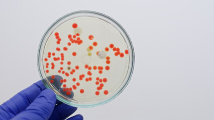 Round red colonies of yeast bacteria on nutrient agar in petri dish on grey clean background, doctor holding petri dish in hands, close-up.