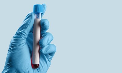 Blood sample in test tube in doctor's hand