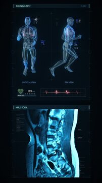 Futuristic technological interface analyzing human male anatomy. Medical profile of patient showing: bones, MRI scan, respiratory system and vital signs.