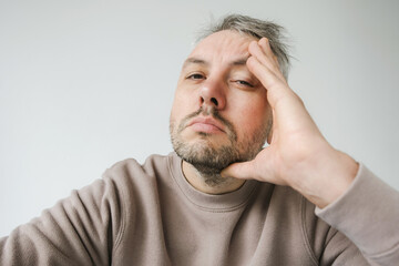 Close-up portrait of a man with his hand resting on his face, conveying a feeling of tiredness, boredom, or contemplation. 