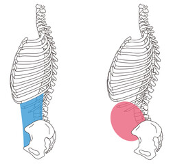 肋骨の開き　反り腰　正しい姿勢と反り腰の姿勢