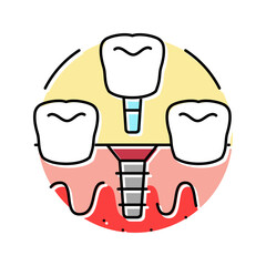femoral hernia repair surgery color icon vector. femoral hernia repair surgery sign. isolated symbol illustration