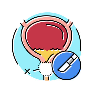prostatectomy urology color icon vector. prostatectomy urology sign. isolated symbol illustration