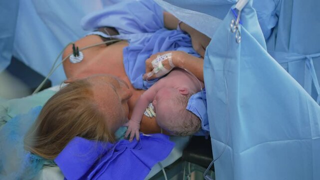 A just-born baby is placed on the mother's chest as the surgeon completes the cesarean section operation. A touching moment of maternal bonding, love, and the first embrace after childbirth in a