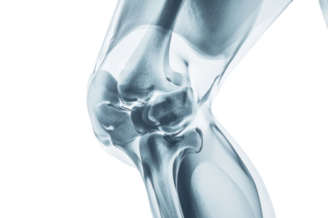 X-ray of knees focusing on joint health, detecting injuries or degenerative diseases, isolated on transparent and white background.PNG image	
 