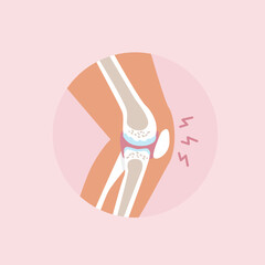 An inflamed knee joint in pain isolated icon. Rheumatoid Arthritis. Vector illustration in flat style.