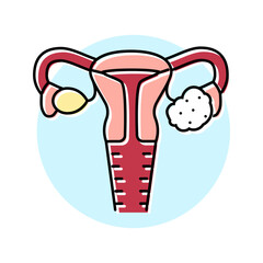 polycystic ovary syndrome woman disease color icon vector. polycystic ovary syndrome woman disease sign. isolated symbol illustration