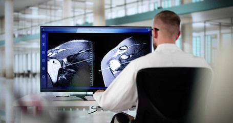 Doctor Screening Knee Bone X Ray