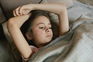 A sick child with skin rashes in bed. Child's skin with many red spot. Allergic reaction, Drug...