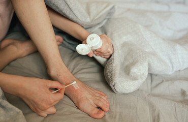 Close up of Child's legs with many red spot. A sick child with skin rashes in bed. Allergic reaction, Drug allergy, Scarlet fever, Atopic dermatitis, Diaper rash, Urticaria, Scabies, Heat rash.