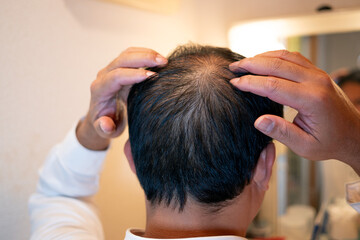 Man checks thinning hair in front of a bathroom mirror