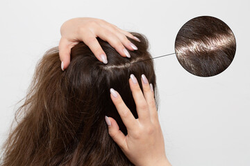 Woman checking scalp for dandruff and hair loss, showing split ends