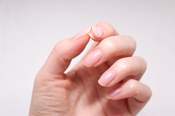 Bad manicure. Peeling gel nail polish on woman nails. 