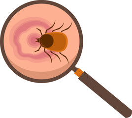 Lyme disease Illustration 