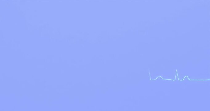 ECG graph of atrial fibrillation, 3d animation render