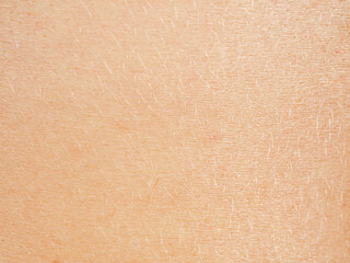 Close-up of skin showing texture and structure, highlighting details important to the study of dermatology