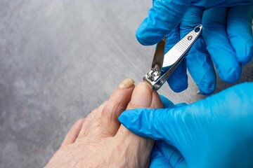 A woman in gloves trims an old woman's toenails with nail clippers. Nail care for the elderly.