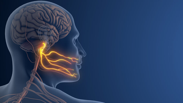 Facial Nerve Pain or Trigeminal Neuralgia
