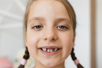 Close-up of smiling Caucasian girl with brown hair and braided pigtails, showing gaps from missing baby teeth, in a bright home setting.