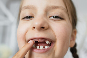 Portrait of young Caucasian girl showing missing teeth with smile. Happy childhood moment captured indoors with playful expression highlighting new growth phase.