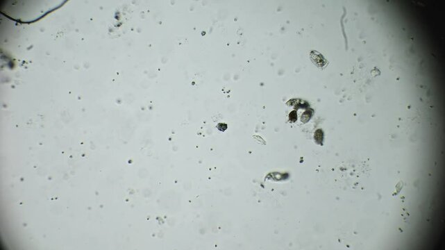 Microscopic scene of rotifers navigating water with organic particles, showcasing their search for food and detailed internal activity.