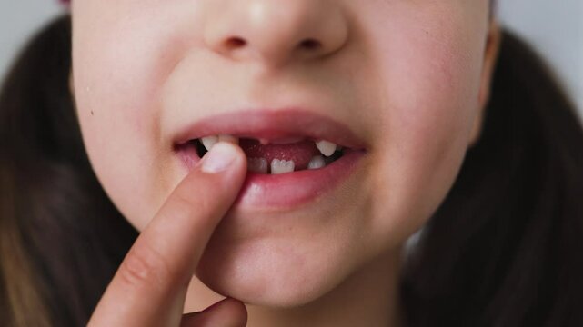Little Caucasian girl shows missing tooth at home, smiling happily. Child holding fallen baby tooth, celebrating natural milestone with excitement and joy.