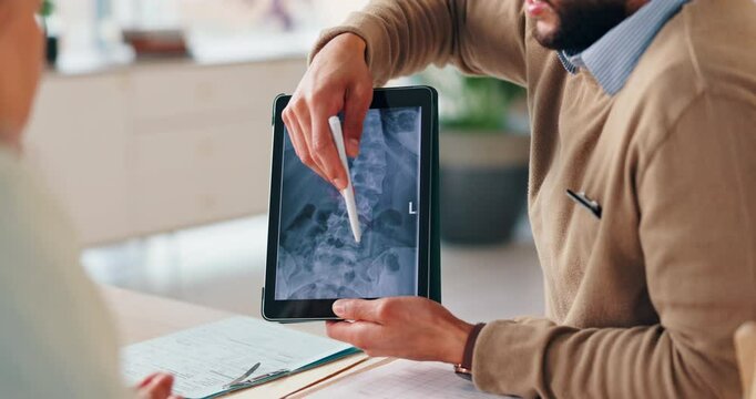 Doctor, hands and tablet screen with patient for x ray results, spine injury or diagnosis at hospital. Closeup, radiologist and client with technology, CT scan or MRI for medical procedure or surgery